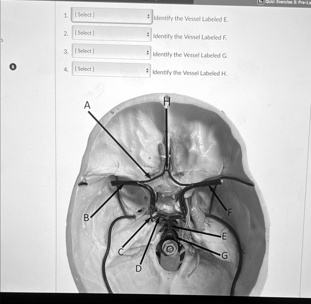 Solved Identify The Vessel Labeled E Identify The Vessel Labeled F