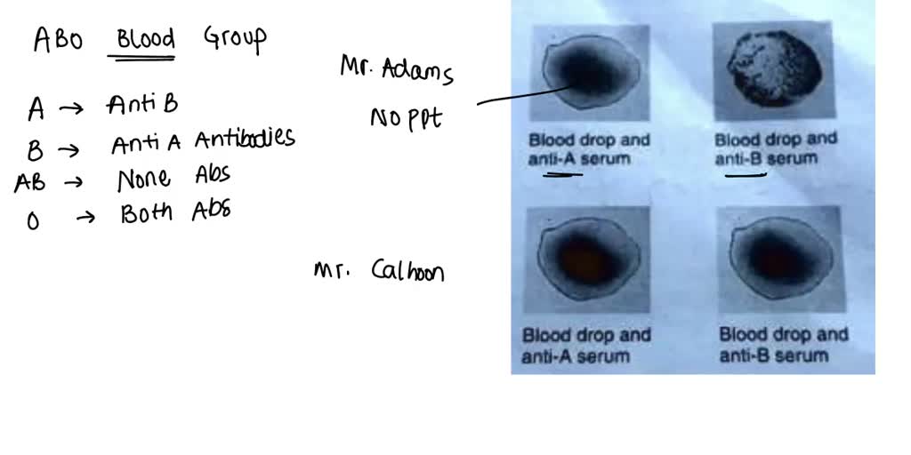 Solved Assume Blood Of Abo Patients Has Been Tested For Abo Blood Type