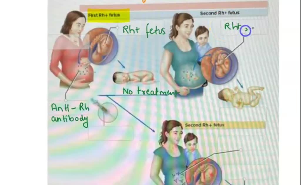 Solved Label The Image To Review The Development And Control Of Rh