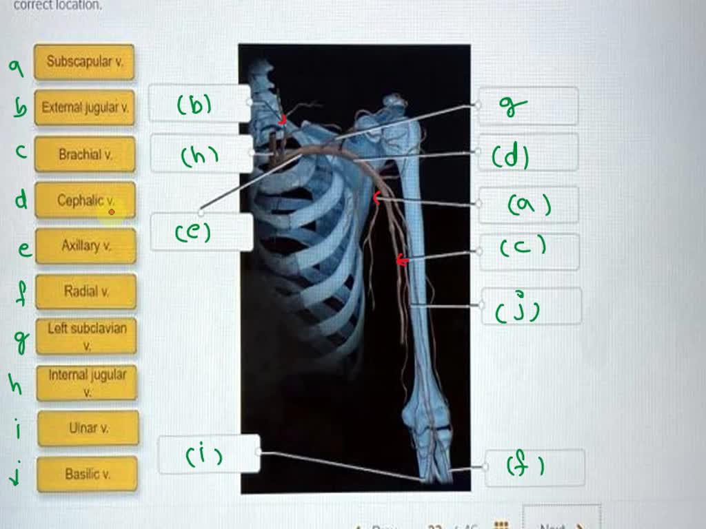 SOLVED Label The Veins Of The Shoulder And Arm In The Illustrated