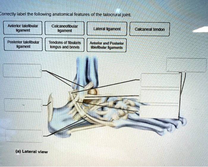 Which Of The Following Refers To Fixation Of A Joint SOLVED: Correctly label the following anatomical features of the