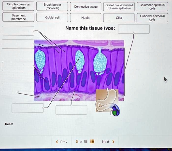 SOLVED Simple columnar epithelium Brush border (microvilli) Connective