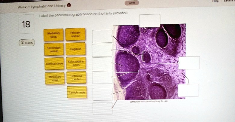 label the photomicrograph based on the hints provided week 3lymphatic ...