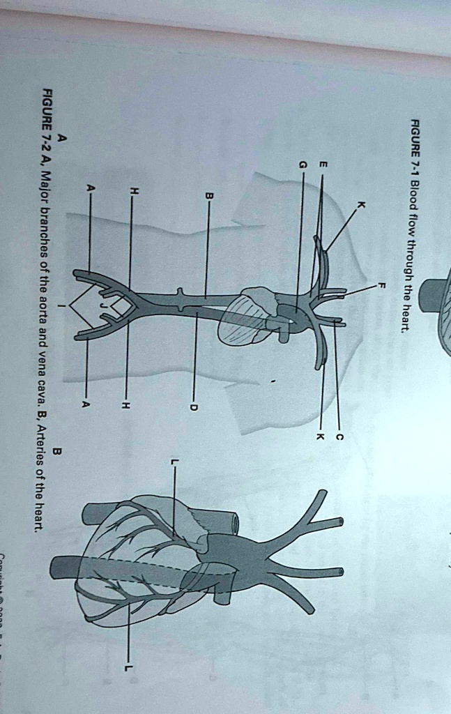 FIGURE 7-1 Blood flow through the heart. A FIGURE 7-2 A, Major branches ...