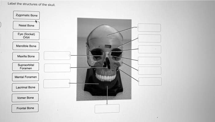 Label the structures of the skull. Zygomatic Bone Nasal Bone Eye ...