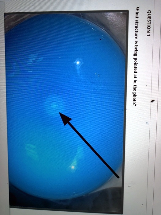 QUESTION 1
What structure is being pointed at in the photo?