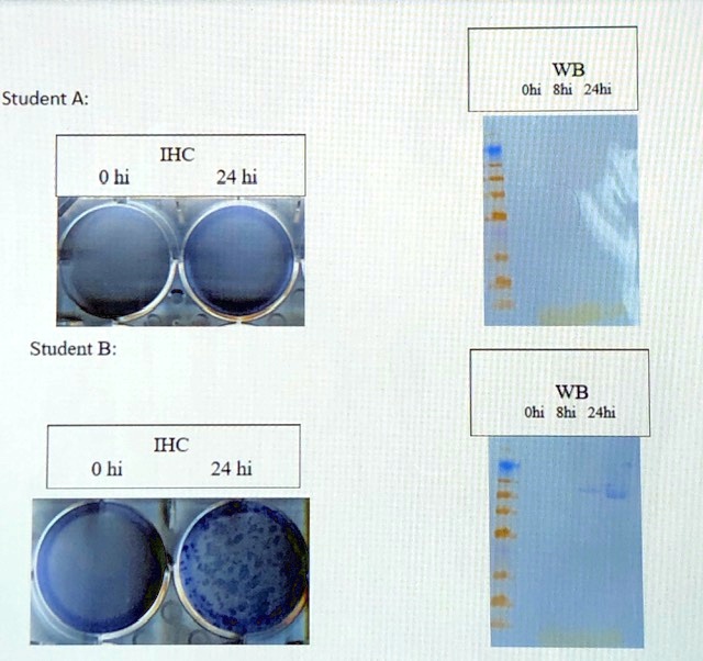 Student A:
IHC
0 hi 24 hi
WB
0hi 8hi 24hi
Student B:
IHC
0 hi 24 hi
WB
0hi 8hi 24hi