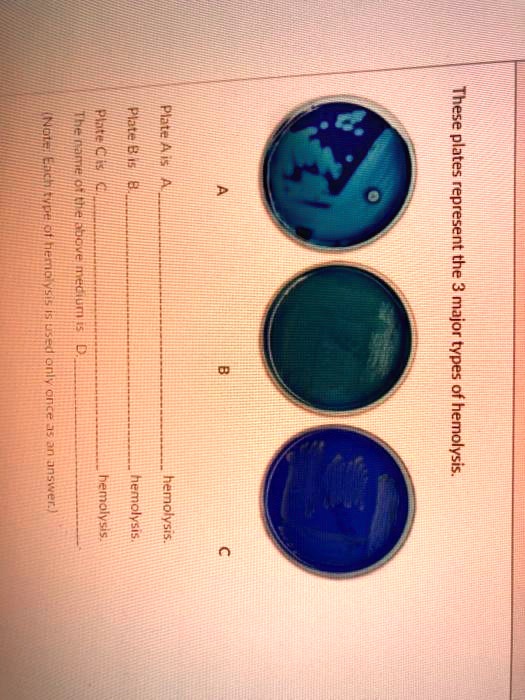 SOLVED These plates represent the different types of hemolysis.