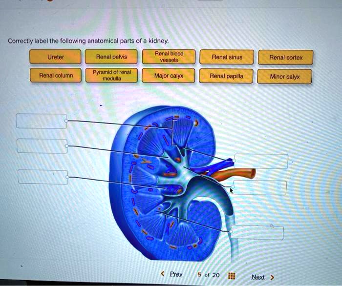 SOLVED: Correctly label the following anatomical parts of a kidney ...