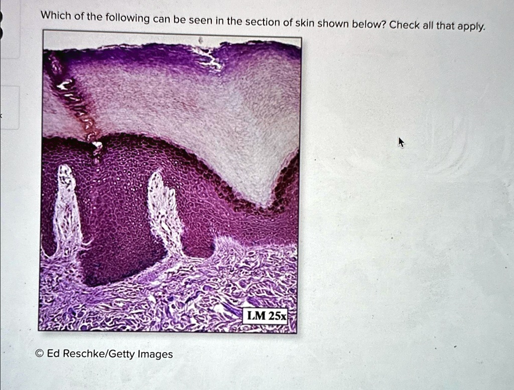 which of the following can be seen in the section of skin shown below ...