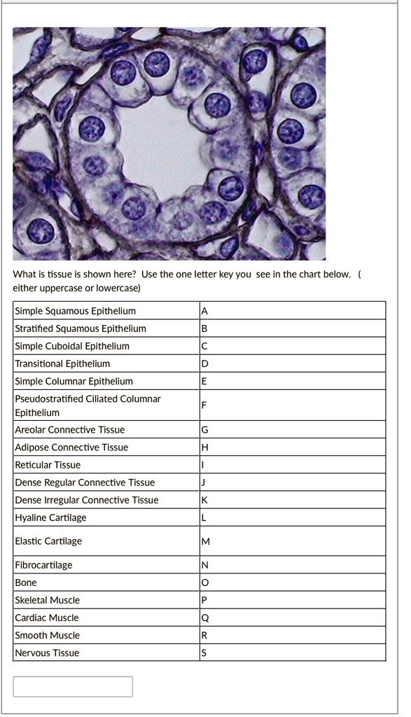 Transitional Vs Simple Columnar SOLVED: What is tissue is shown here? Use the one letter key you see in ...