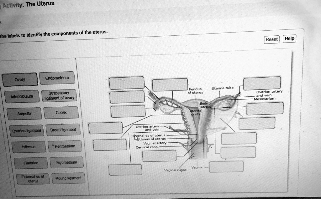 SOLVED Activity The Uterus Labels to identify the components of the