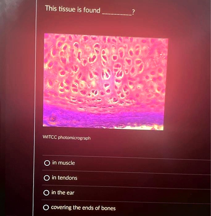 This tissue is found  ?
WITCC photomicrograph
in muscle
in tendons
in the ear
covering the ends of bones