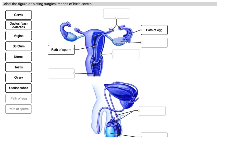 SOLVED Label the figure depicting surgical means of birth control