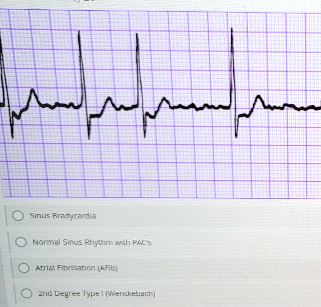 SOLVED: Sinus Bradycardia Normal Sinus Rhythm with PACs Atrial ...