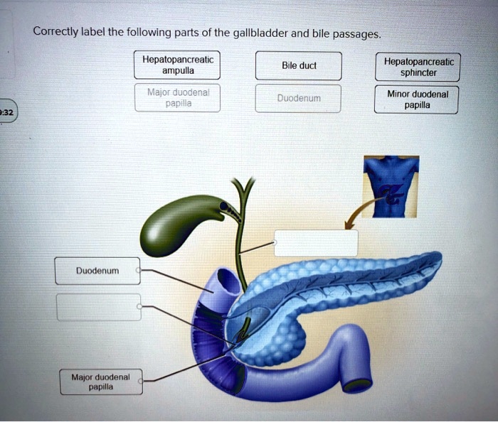 SOLVED: Correctly label the following parts of the gallbladder and bile ...
