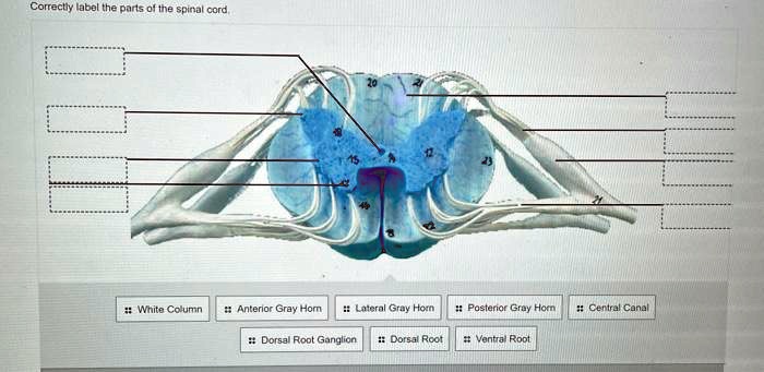 SOLVED: label Correctly label the parts of the spinal cord White Column ...