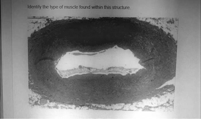 Identify the type of muscle found within this structure.