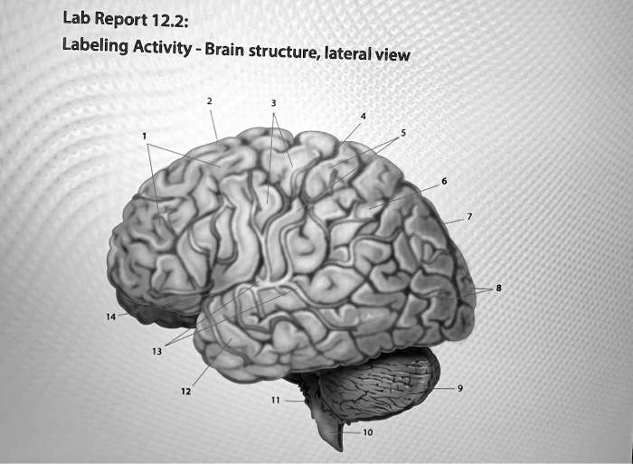 Brain Structure Lab SOLVED: Lab Report 12.2: Labeling Activity- Brain structure; lateral view