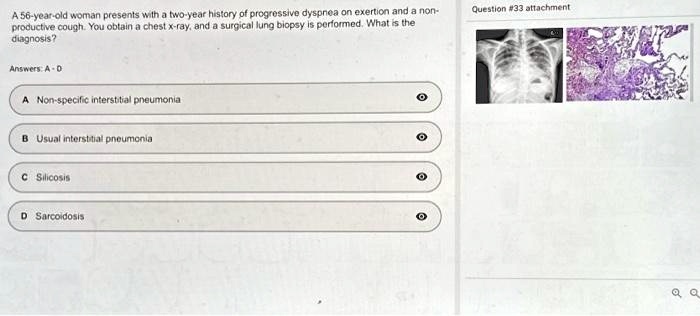A 56-year-old woman presents with a two-year history of progressive ...