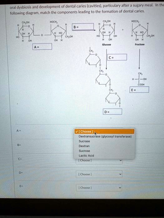 VIDEO solution Oral dysbiosis and development of dental caries