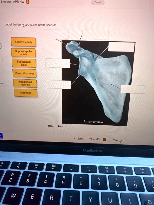 SOLVED: Label the bony structures of the scapula. - Glenoid cavity