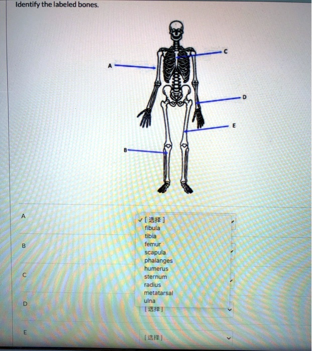 Solved Identify The Labeled Bones V I Fibula Tibia Femur Scapula Phalanges Humerus