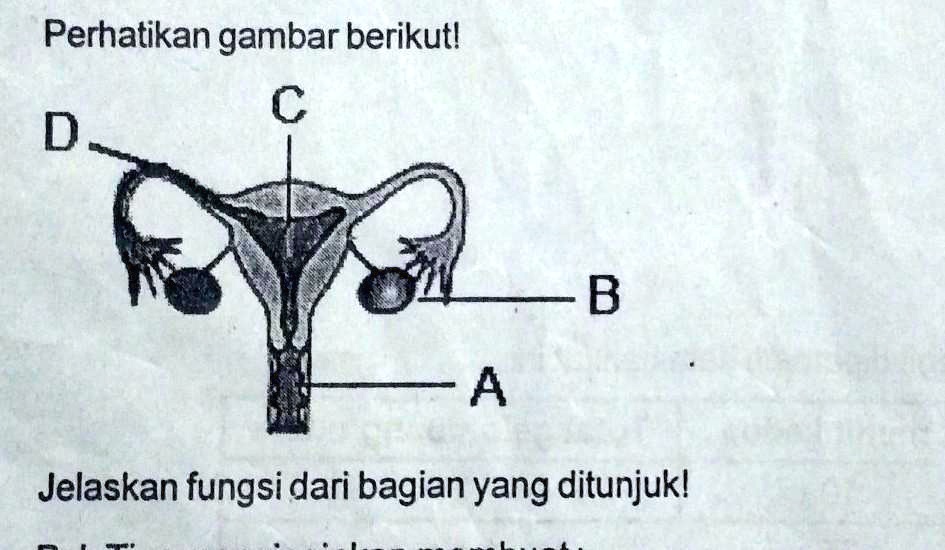 SOLVED: Perhatikan Gambar Berikut!Jelaskan Fungsi Dari Bagian Yang ...