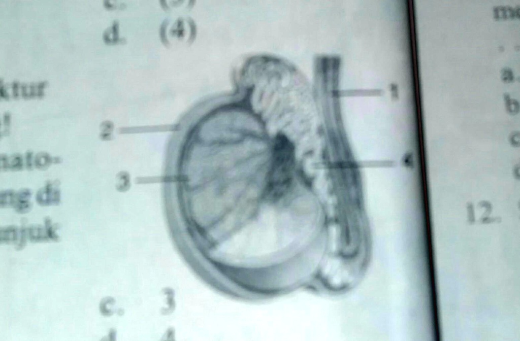 SOLVED Perhatikan Struktur Testis Disamping Prises Spermatogenesis Berlangsung Do Bagian Yang