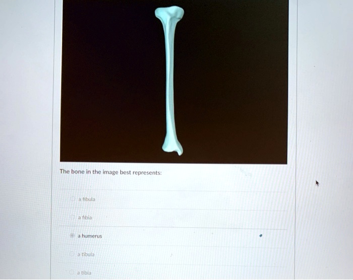 SOLVED: The bone in the image best represents: a fibula a fibula a ...