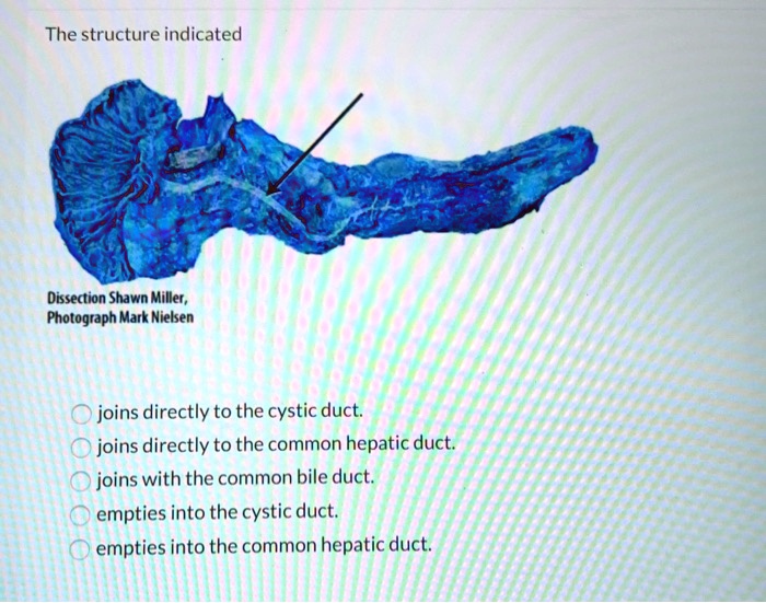 SOLVED The structure indicated joins directly to the cystic duct and