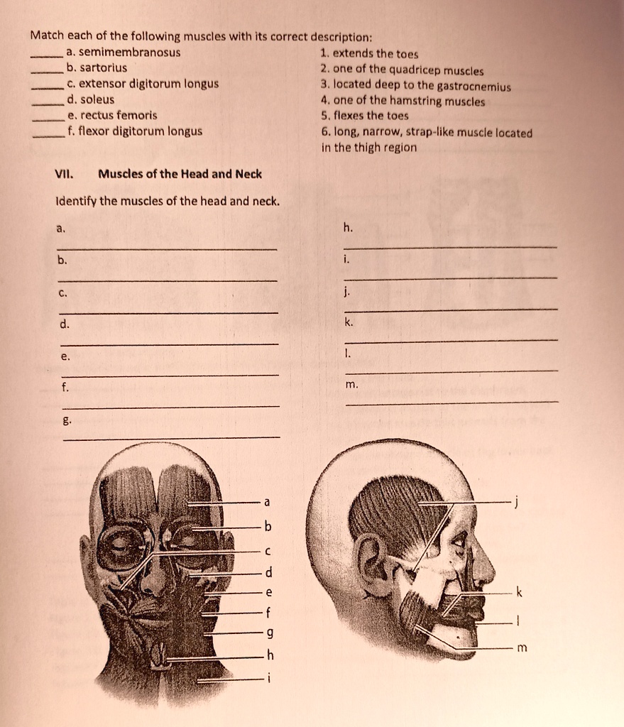 Match each of the following muscles with its correct description:
a. semimembranosus 1. extends the toes
b. sartorius 2. one of the quadricep muscles
c. extensor digitorum longus 3. located deep to the gastrocnemius
d. soleus 4. one of the hamstring muscles
e. rectus femoris 5. flexes the toes
f. flexor digitorum longus 6. long, narrow, strap-like muscle located
in the thigh region
VII. Muscles of the Head and Neck
Identify the muscles of the head and neck.
a. h.
b. i.
c. j.
d. k.
e. l.
f. m.
g.