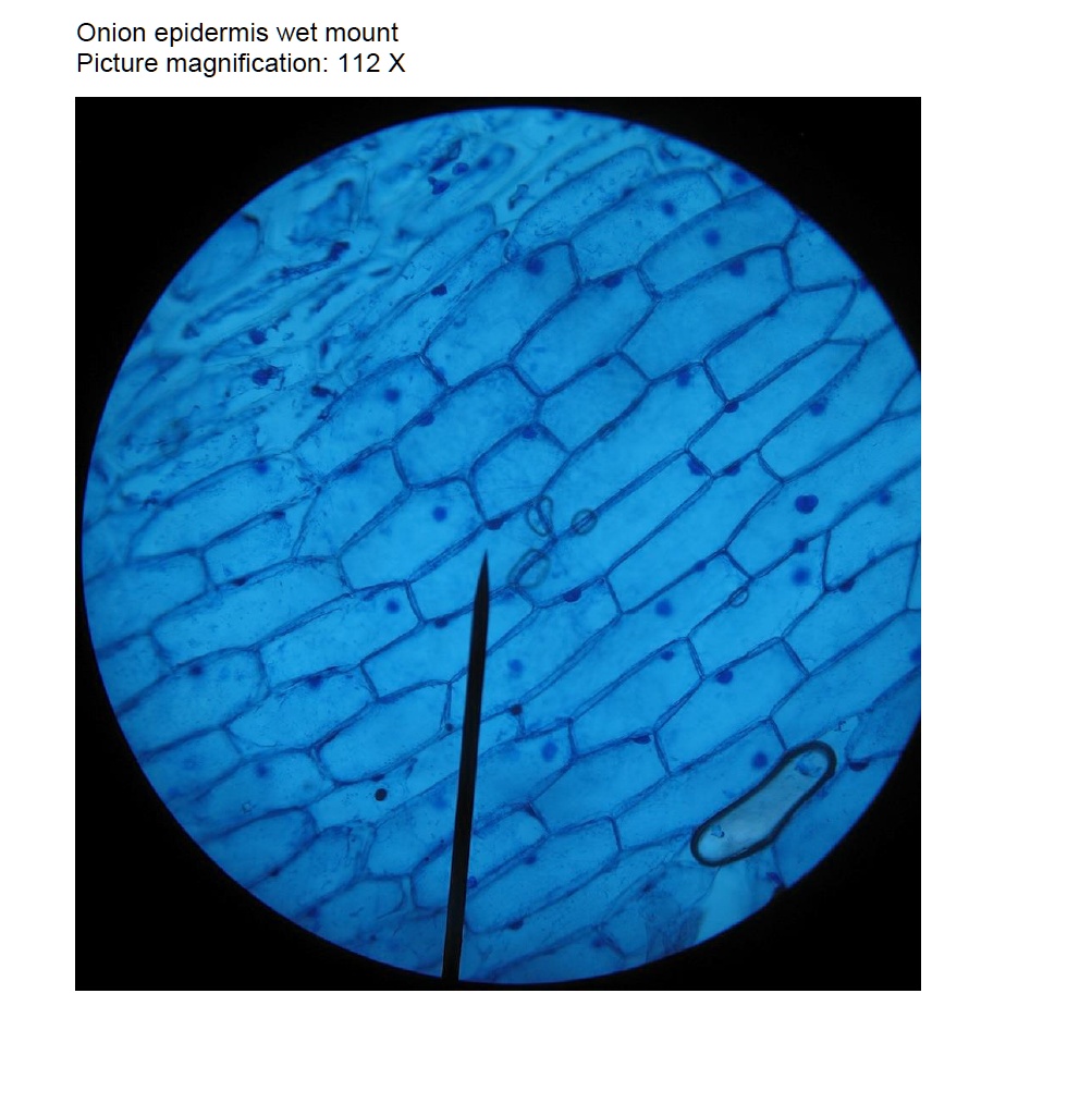 SOLVED Onion epidermis wet mount Picture magnification 112 X
