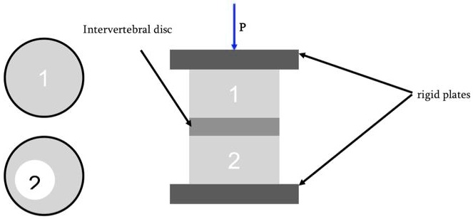 Intervertebral disc 1 2 P 1 2 rigid plates