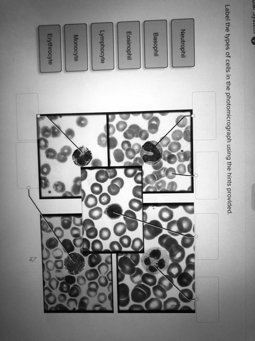 SOLVED: Erythrocyte Monocyte Lymphocyte Eosinophil Basophil Neutrophil