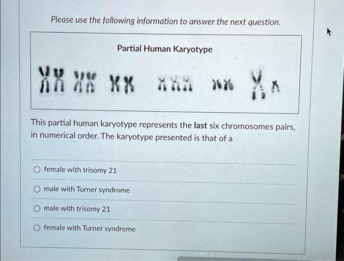 Partial Human Karyotype
This partial human karyotype represents the last six chromosomes pairs, in numerical order. The karyotype presented is that of a
female with trisomy 21
male with Turner syndrome
male with trisomy 21
female with Turner syndrome