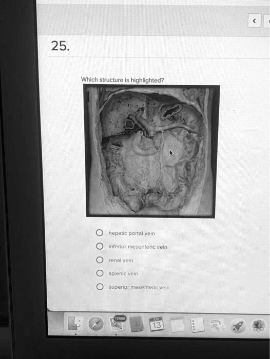 SOLVED: Which structure is highlighted? hepatic portal vein, inferior ...