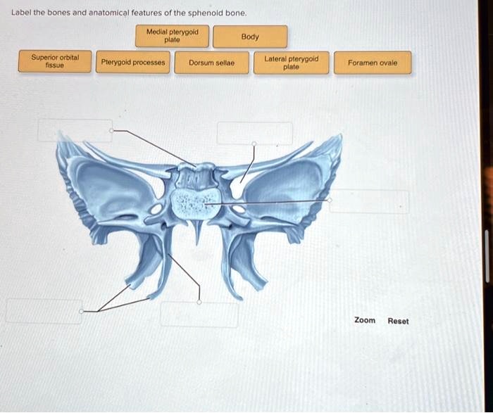 SOLVED: Texts: Label the bones and anatomical features of the sphenoid ...