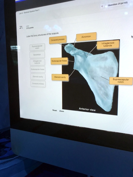 SOLVED: Question 21 (of 47) Label the bony structures of the scapula