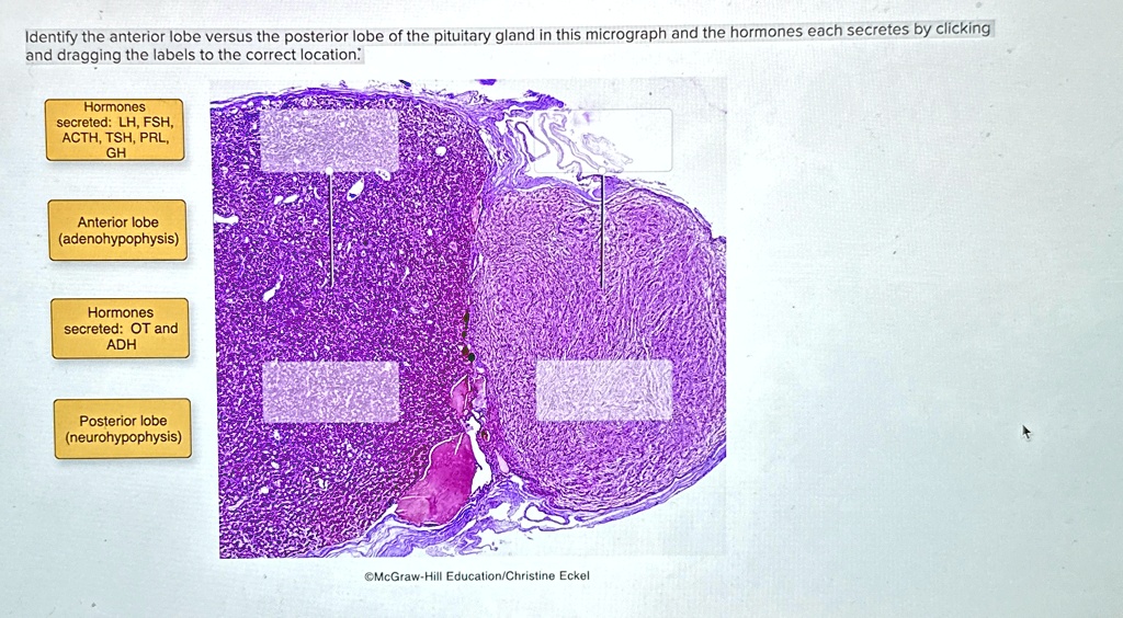 Identify the anterior lobe versus the posterior lobe of the pituitary ...