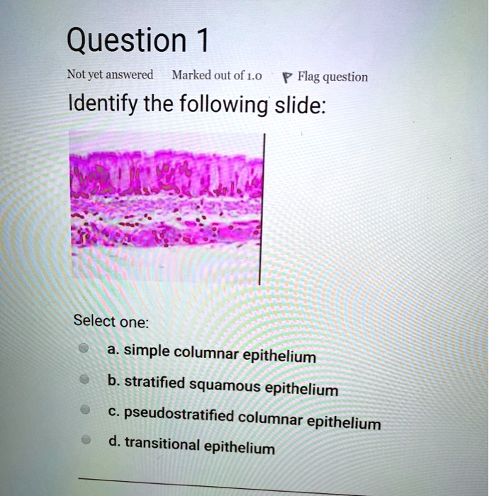 Transitional Vs Simple Columnar Question 1 Not yet answered Marked out of 1.0 Flag question Identify ...