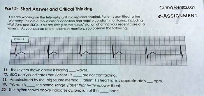 Part 2: Short Answer and Critical Thinking
You are working on the telemetry unit in a regional hospital. Patients admitted to the
telemetry unit are often in critical condition and require constant monitoring, including
vital signs and EKGs. You are sitting at the nurses' station charting your recent care of a
patient. As you look up at the telemetry monitors, you observe the following.
CARDIO PHYSIOLOGY
e-ASSIGNMENT
Patient 1
16. The rhythm shown above is lacking  waves.
17. EKG analysis indicates that Patient 1's  are not contracting.
18. As calculated by the 'big square method', Patient 1's heart rate is approximately  bpm.
19. This rate is  the normal range. (faster than/within/slower than)
20. The rhythm shown above indicates dysfunction of the  node.
