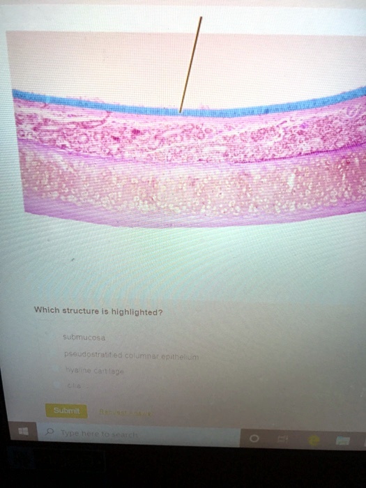 SOLVED: Submucosa, Pseudostratified columnar epithelium, Hyaline ...