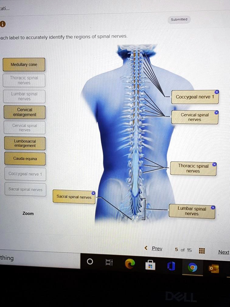 SOLVED: Title: Accurate Identification of Spinal Nerve Regions ...