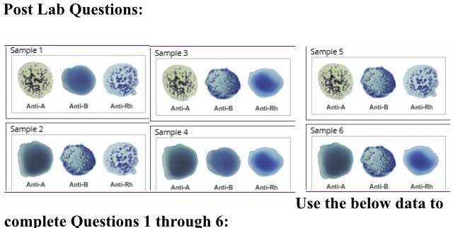 SOLVED: A person with blood type of Sample #4 could safely receive a ...