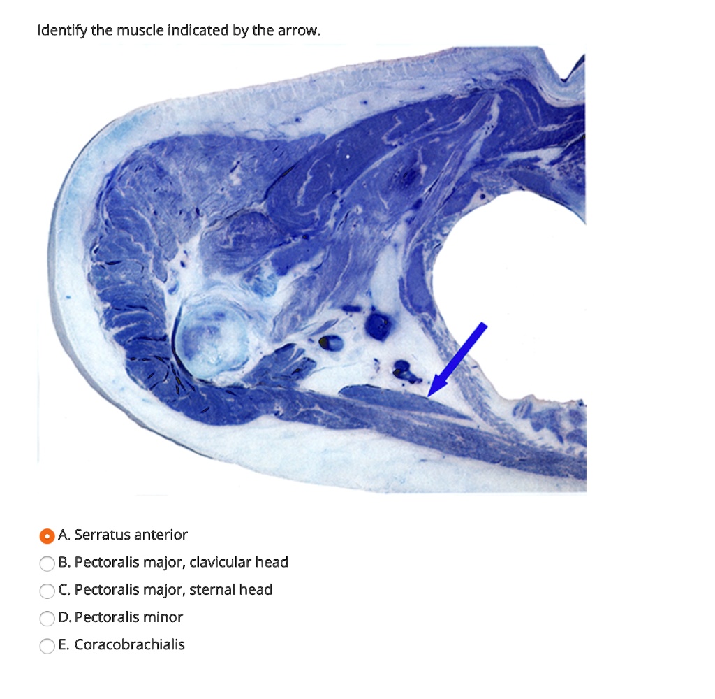 SOLVED: Identify The Muscle Indicated By The Arrow: A Serratus Anterior ...