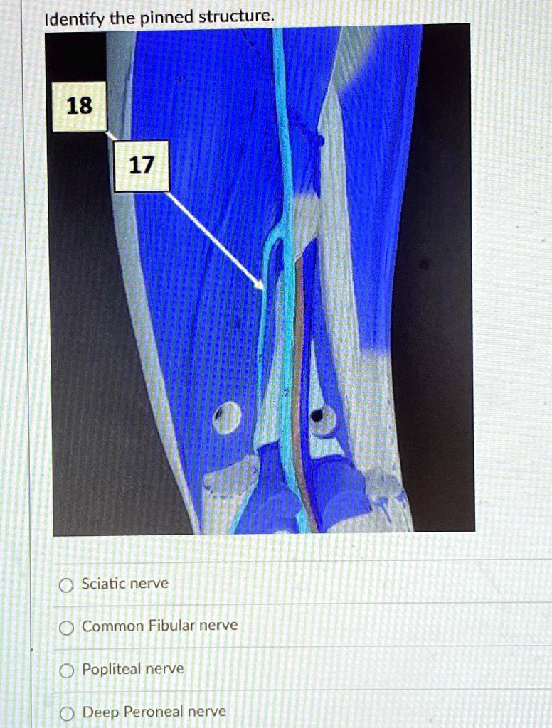 SOLVED: Identify the pinned structure. 18 Sciatic nerve Common Fibular ...