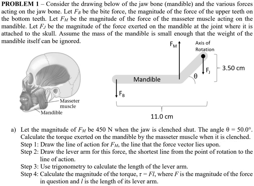 SOLVED PROBLEM 1 Consider the drawing below of the jaw bone
