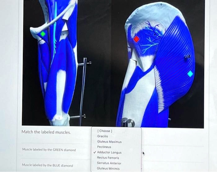 SOLVED Texts Match the labeled muscles. What is the muscle labeled