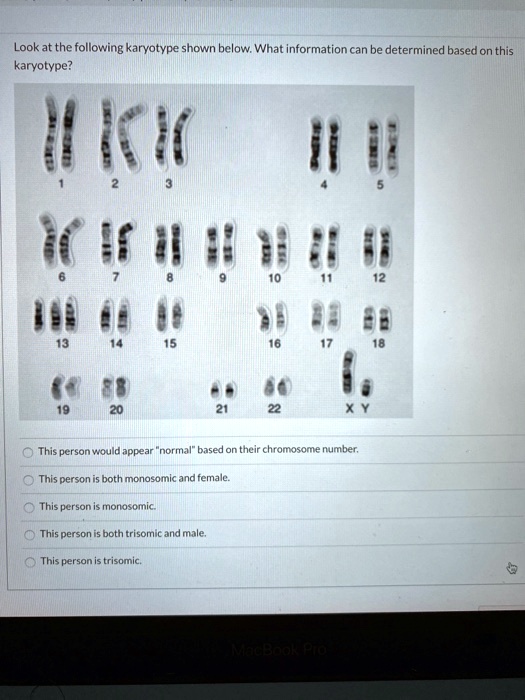 SOLVED:Lookat the following karyotype shown below What information can ...